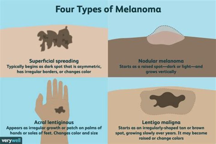Is melanoma painful or itchy?