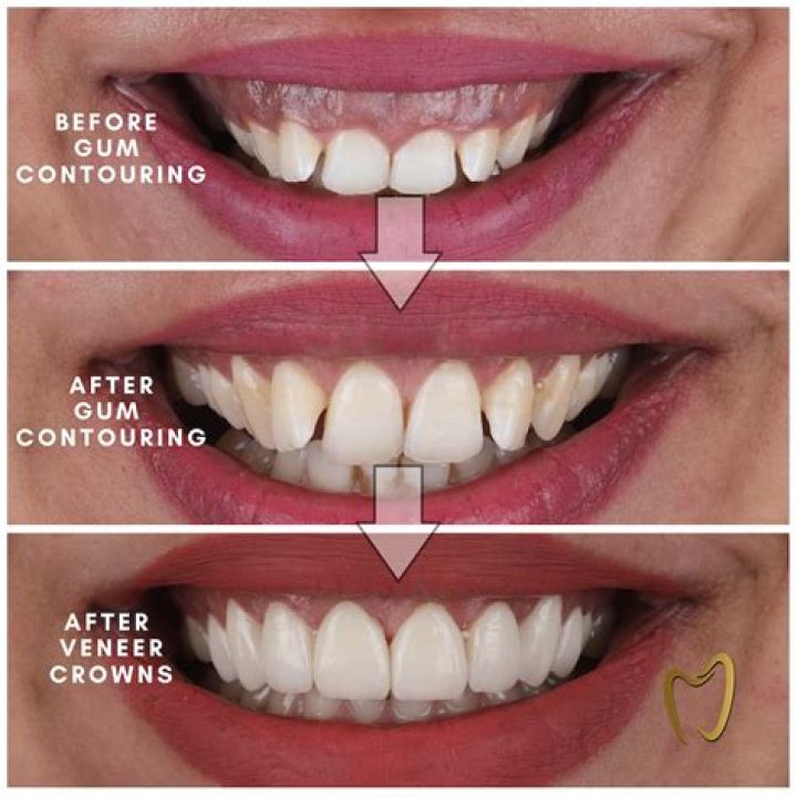 Is salt water good for teeth and gums?