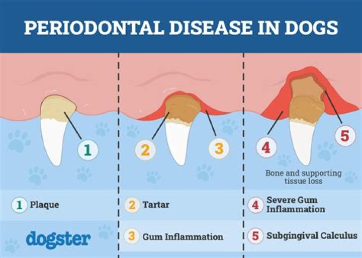 Is Sensodyne Good for periodontal disease?