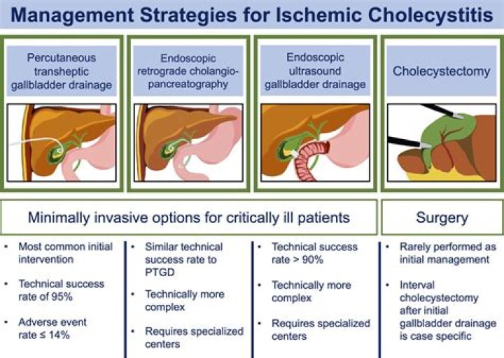 Is surgery necessary for cholecystitis?