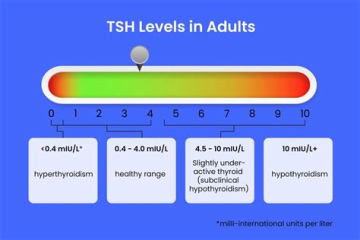 Is TSH of 30 high?