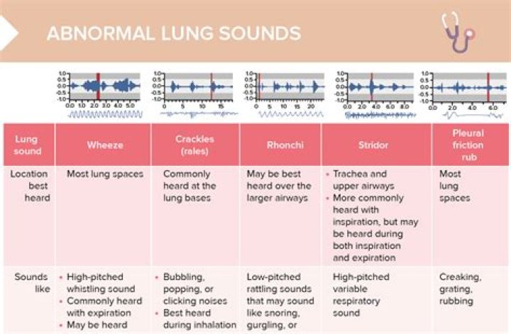 What are the easiest sounds for a baby to say?