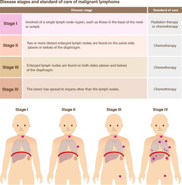 What are the final stages of lymphoma?