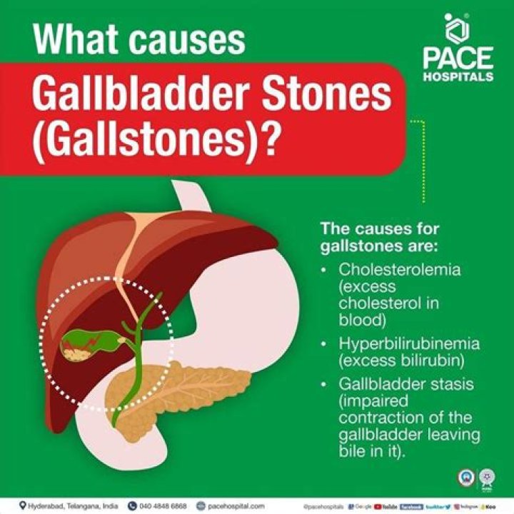 What causes inflamed gallbladder without stones?
