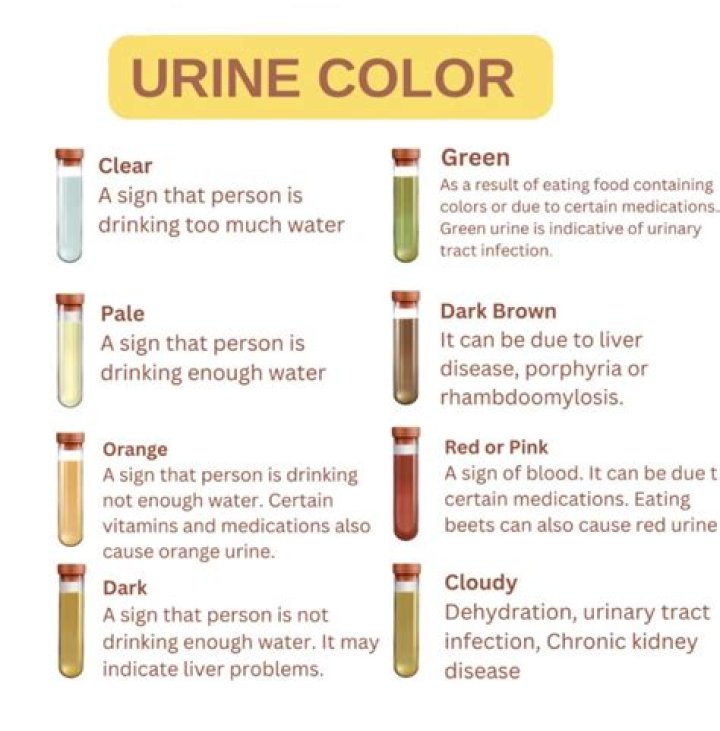 What color is your urine when kidneys are failing?