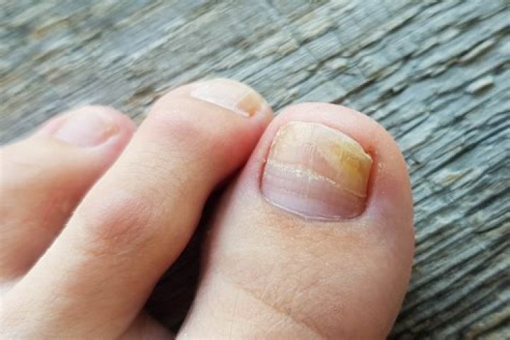 What do red painted toenails mean?
