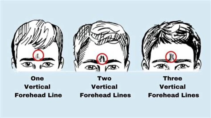What does a flat forehead mean?