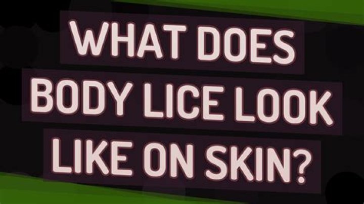 What does body lice look like on skin?