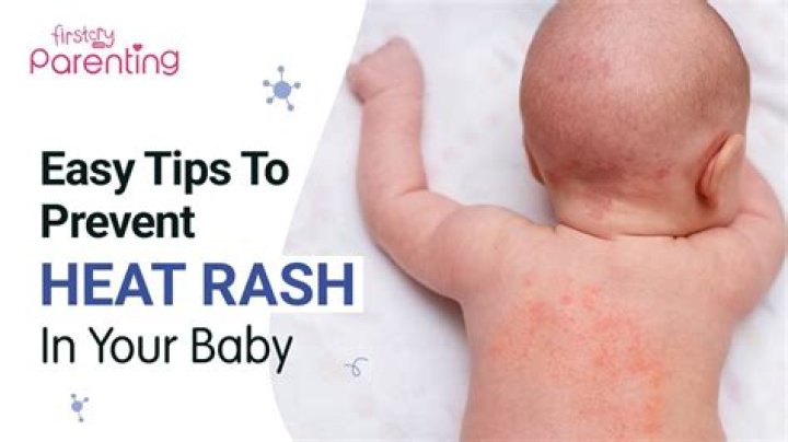 What does heat rash look like when it's healing?