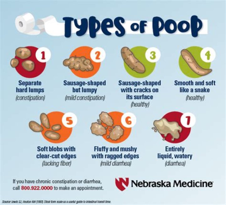 What does ideal poop look like?