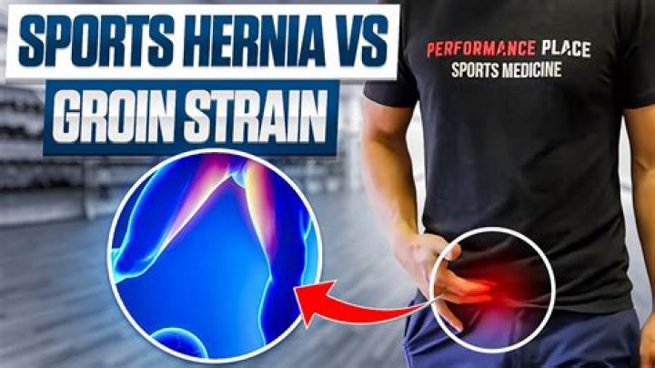 What is a Sportsmans hernia?