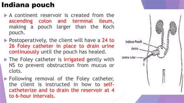 What is an Indiana pouch bladder?