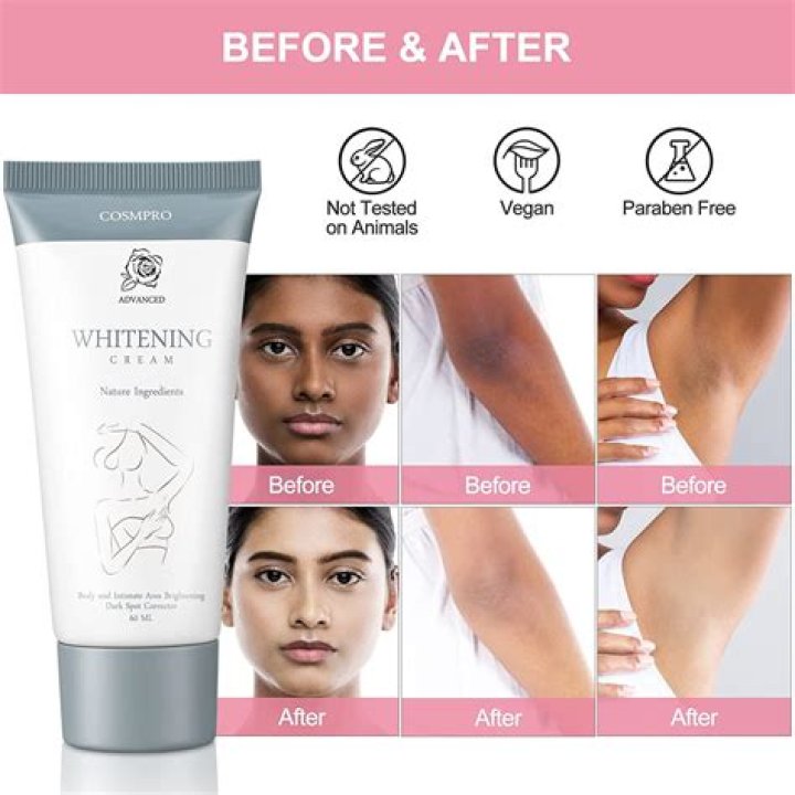 What is the strongest lightening cream?