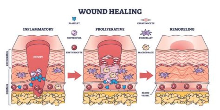 What's the best way to heal a wound?