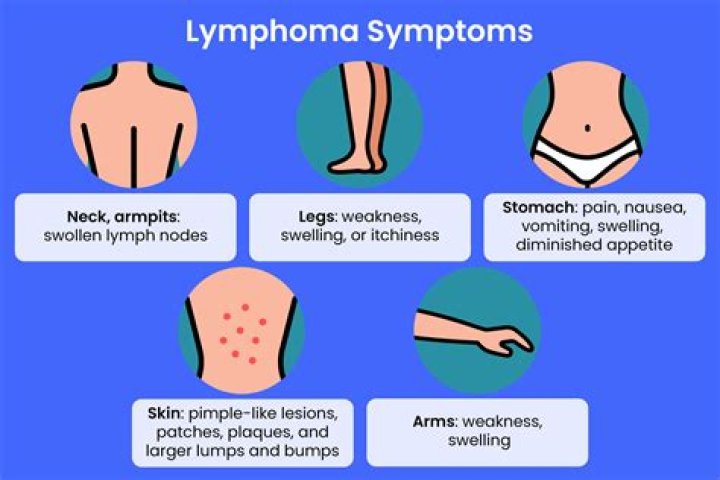 Where is the pain with lymphoma?