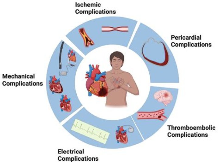 Which of the following are complications of sepsis?