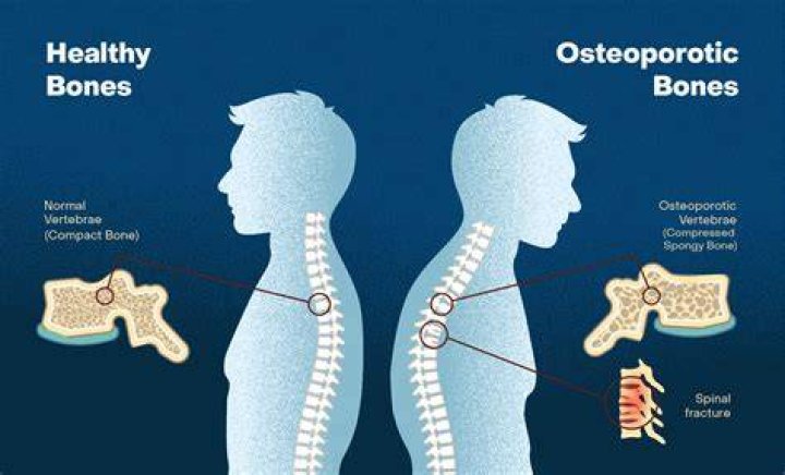 Why do bones turn orange?