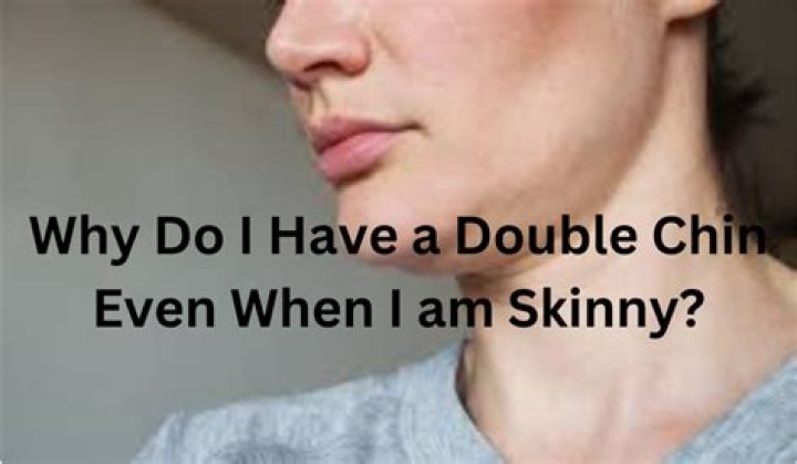 Why do I have a double chin when I am skinny?