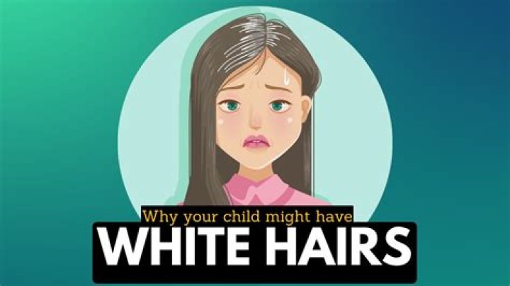 Why do I have white hair at 29?