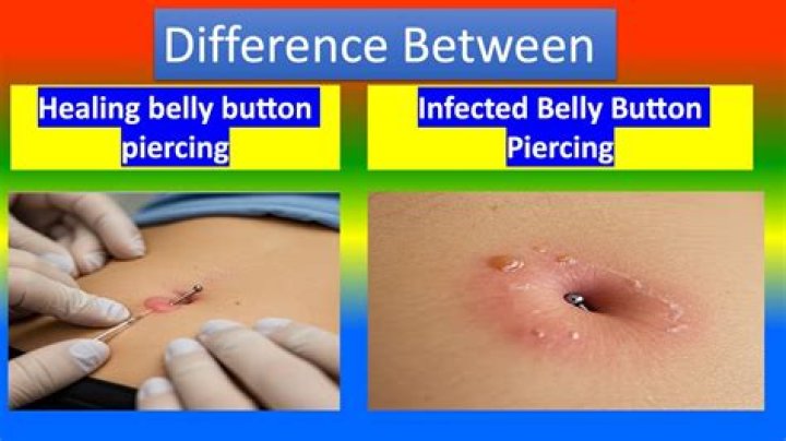 Why do I like to touch my belly button?