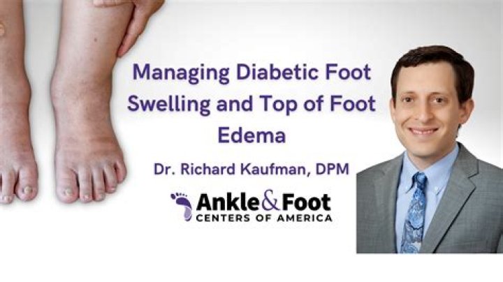 Why do my ankles ache when I get up in the morning?