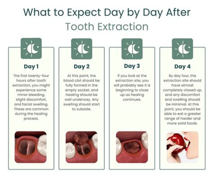 Why does my jaw still hurt 3 weeks after tooth extraction?