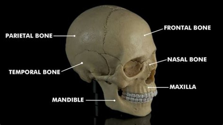 Why does my skull have a dent in the back?