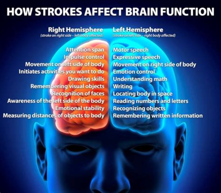 Why does stroke only affect one side?