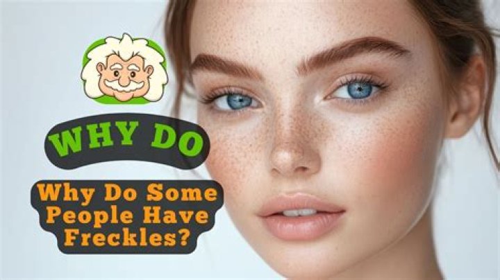 Why have my freckles gone away?