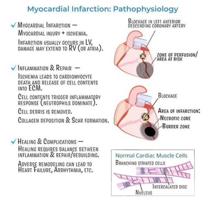 Why is clopidogrel given in myocardial infarction?
