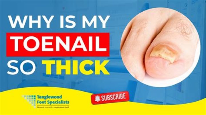 Why is my nail not going into wall?